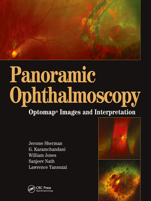 Title details for Panoramic Ophthalmoscopy by Jerry Sherman - Wait list